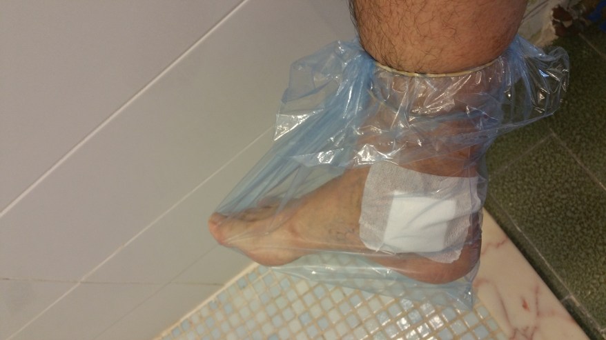 Pie en bolsa de congelar pescado para que no se moje el apósito